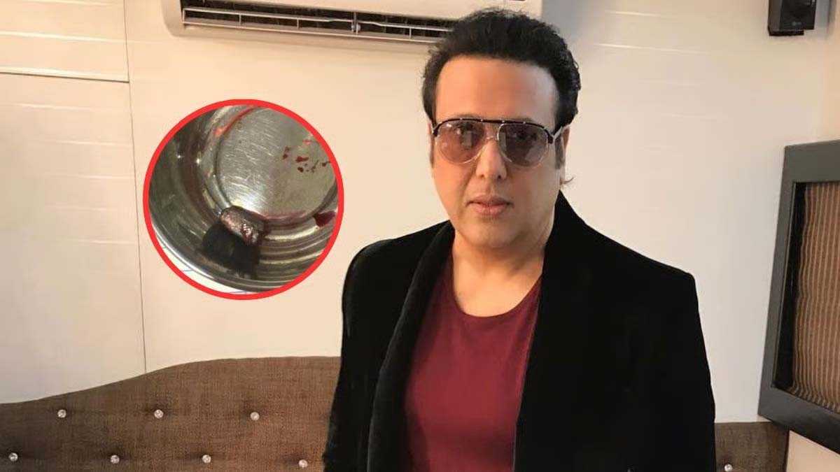 Picture Of 9mm Bullet That Hit Govinda's Knee Bone Surfaces; Actor To Be Under Observation For 48 Hours, Says Doctor